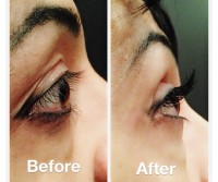 Eyelashes